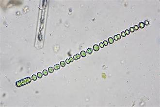 Anabaena circinalis